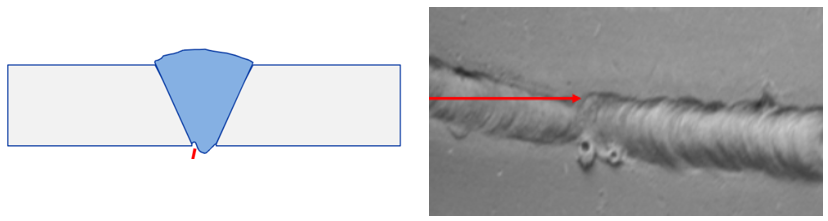 Root undercut Root undercut defect